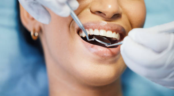Best Emergency Denture Repair in St Helena, CA