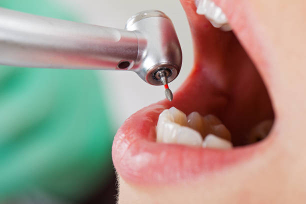 Best Emergency Treatment for Oral Infections in St Helena, CA